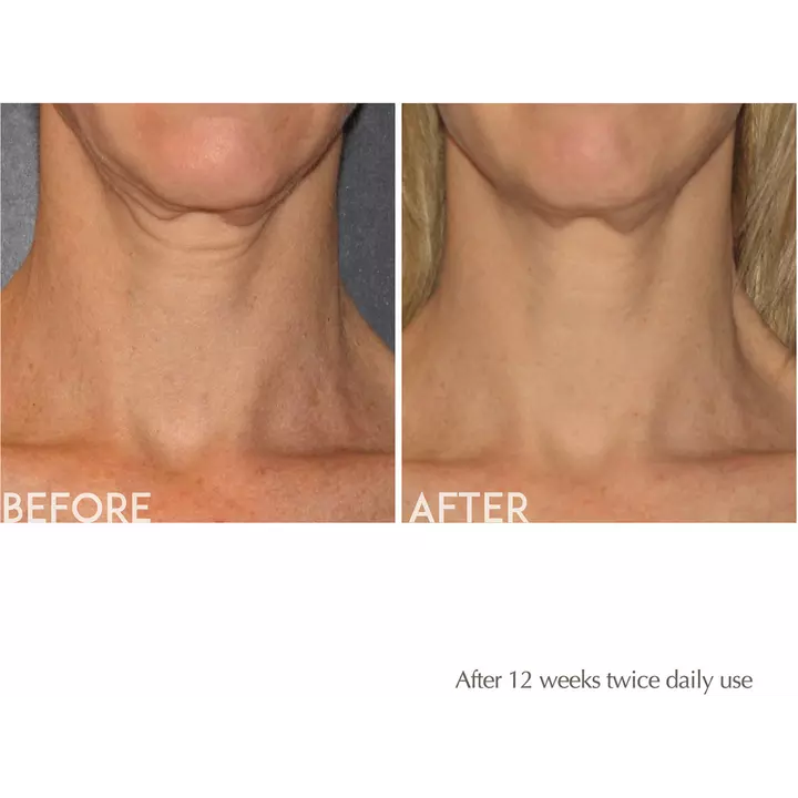 Age Reverse Antiaging Toning Neck Cream
