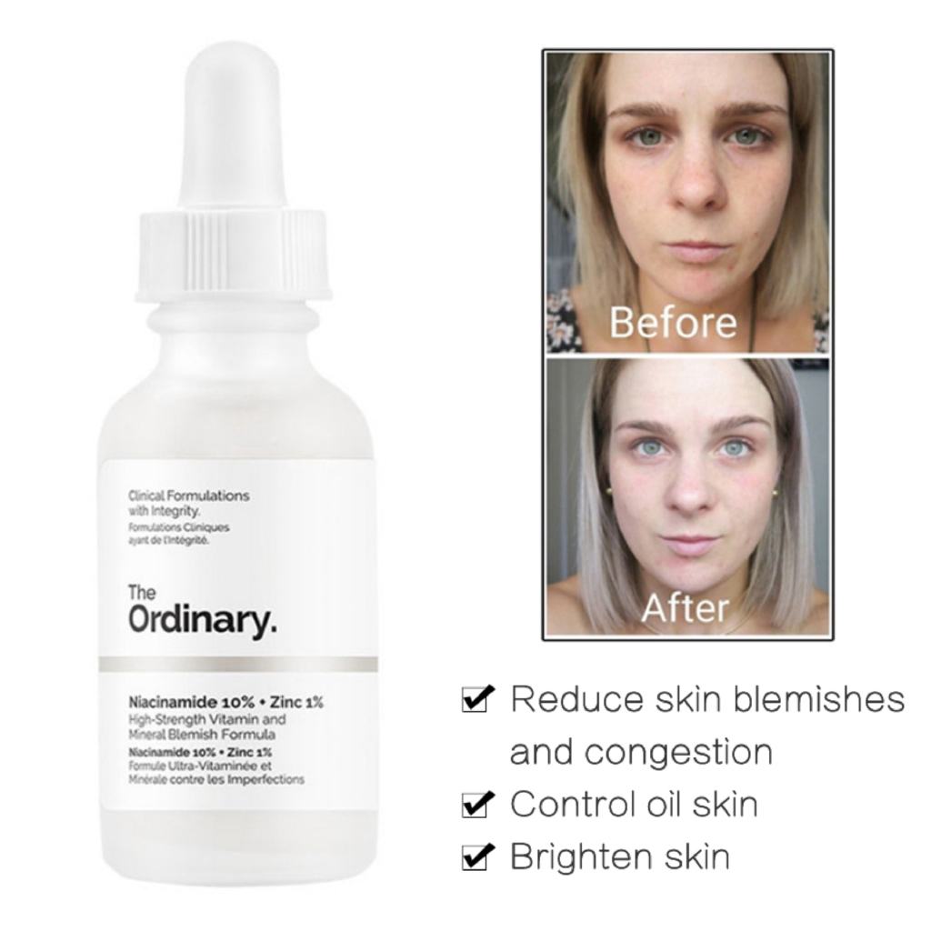 Niacinamide 10% + Zinc 1%