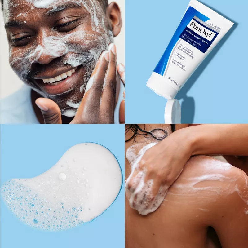 Acne Foaming Wash 10% Benzoyl Peroxide Maximum Strength -Limpiador anti acne