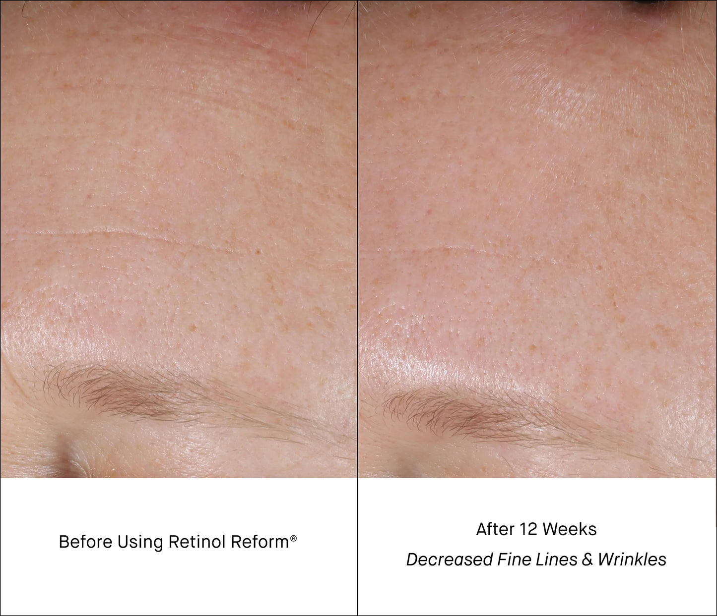 Minis antiaging Retinol duo