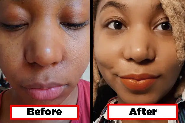 AHA 30% + BHA 2% Peeling Solution (TSuero exfoliante)