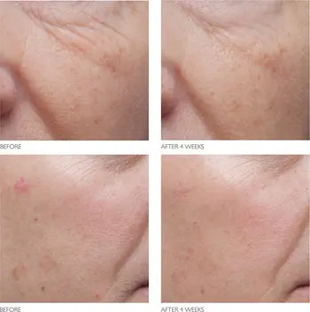 Age Arrest Anti-Wrinkle Cream (Crema antiarrugas)