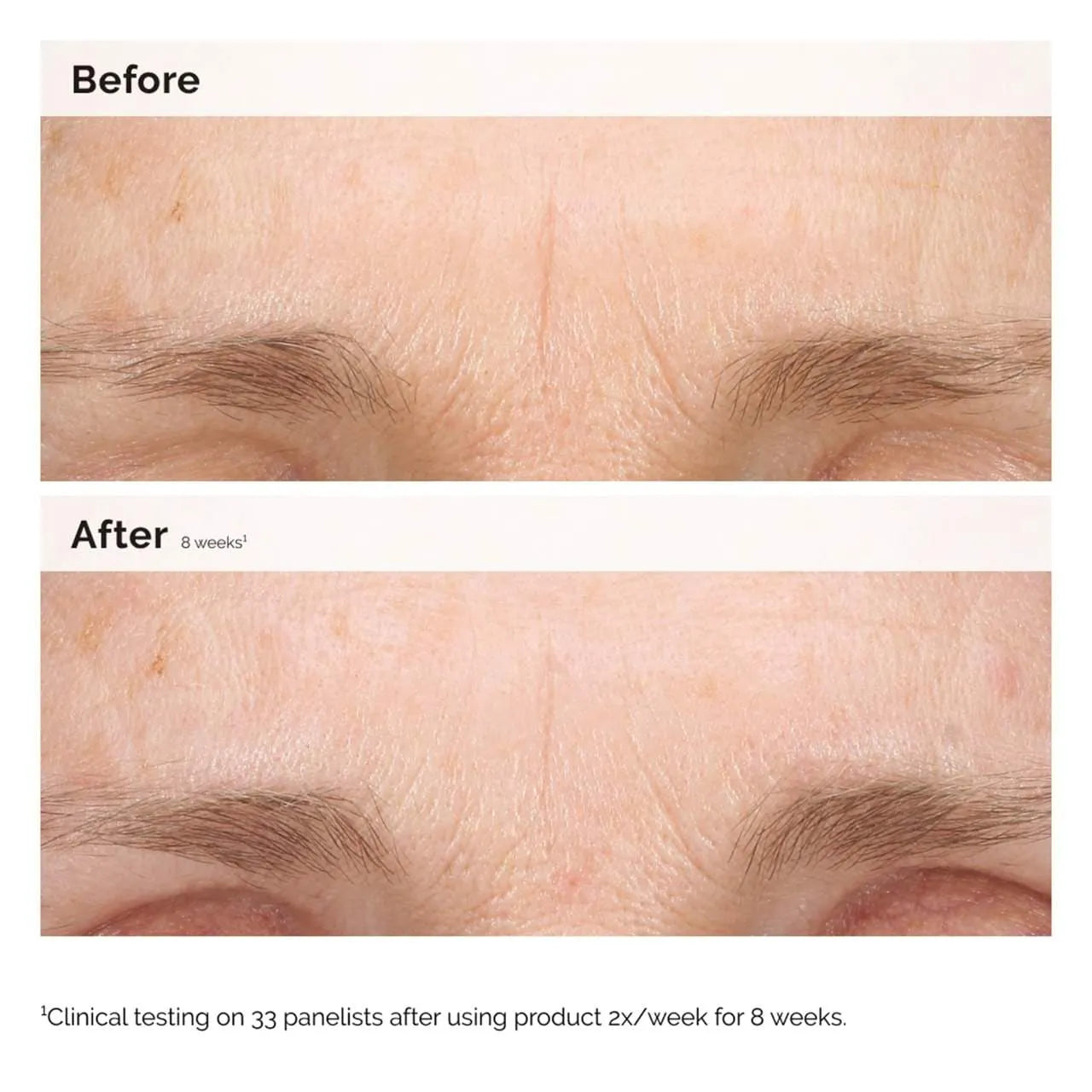 Retinal 0.2% Emulsion