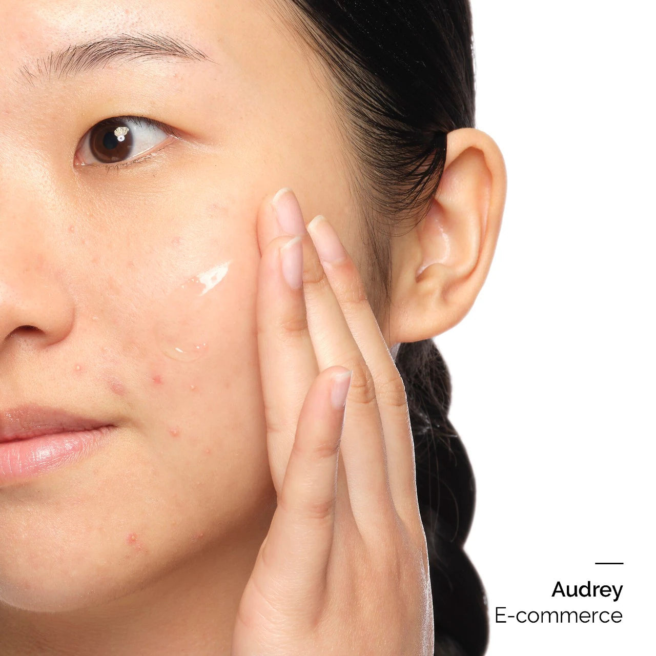 Aloe 2% + NAG 2% Solution Serum