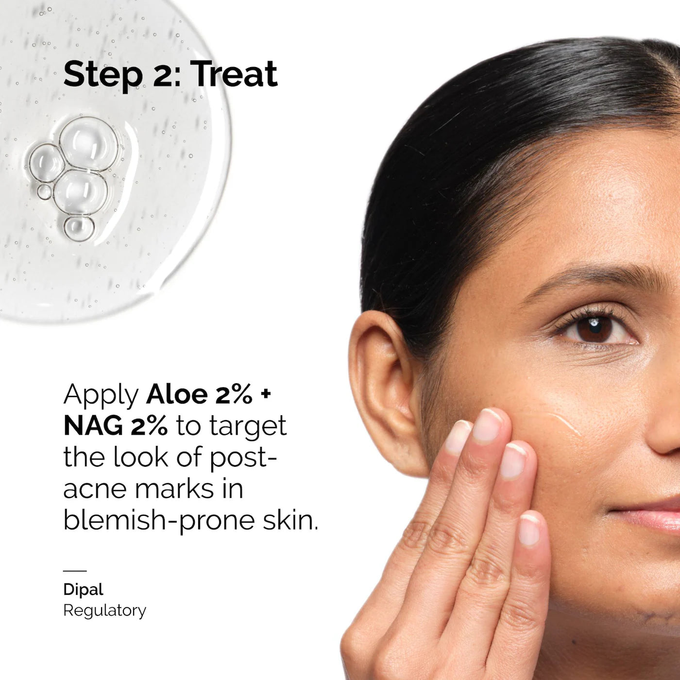 Aloe 2% + NAG 2% Solution Serum