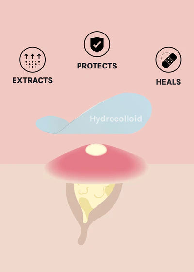 Parches anti acne Skin Invisible