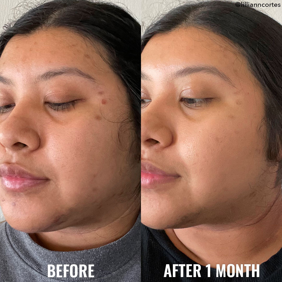Glycolic Exfoliating Toner (Tónico exfoliante)