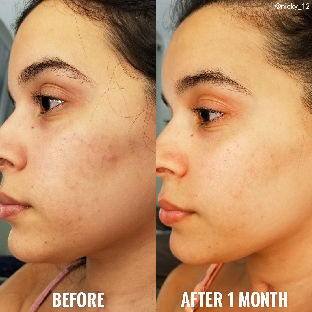 Glycolic Exfoliating Toner (Tónico exfoliante)