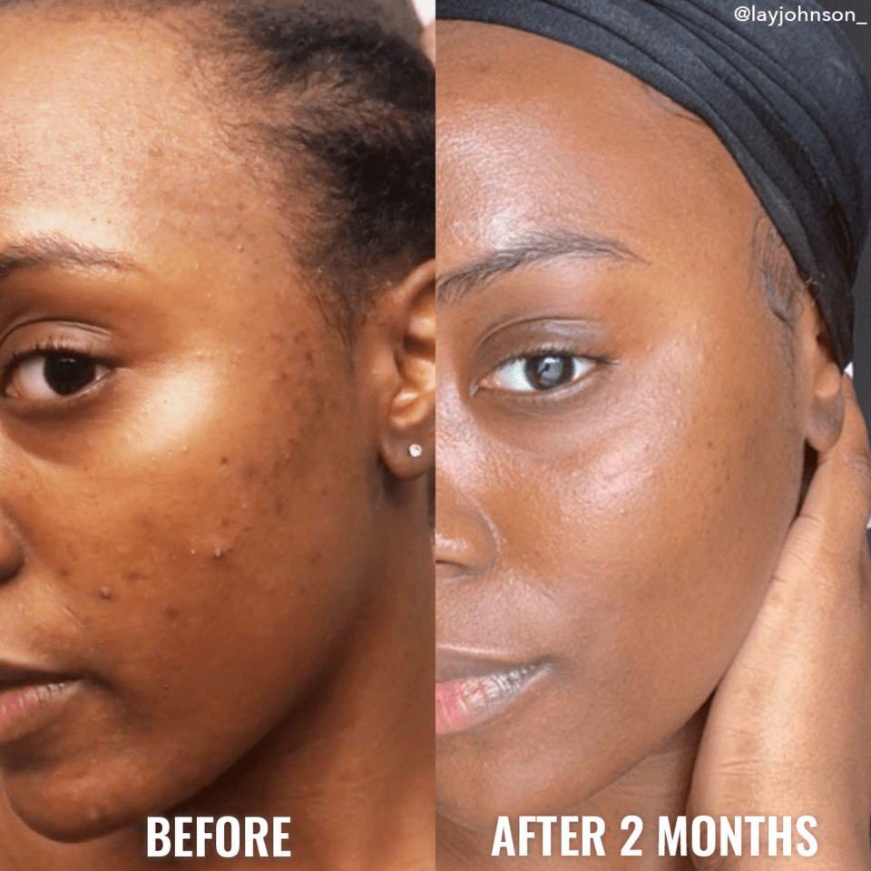 Gentle Retinol Cream