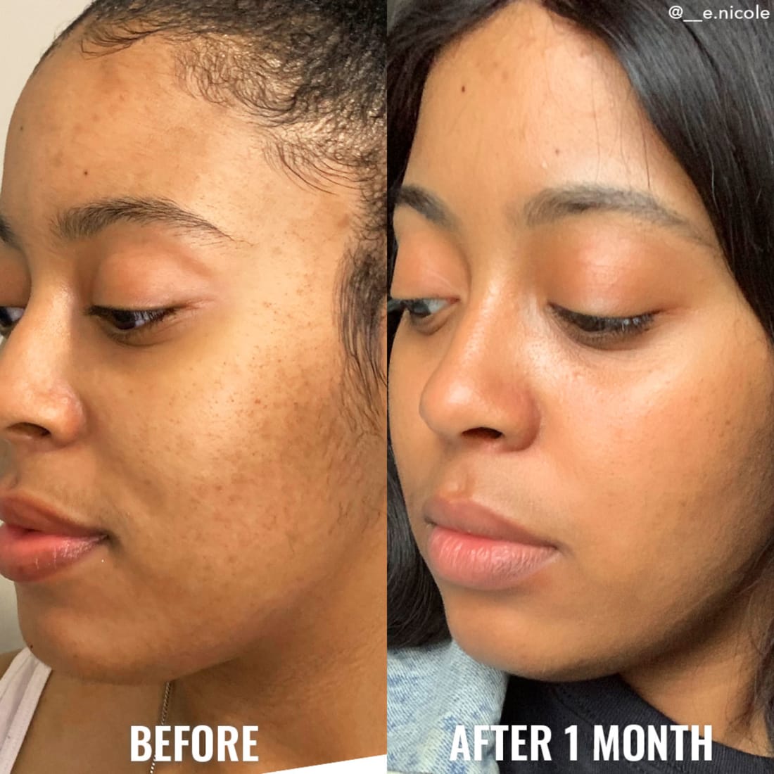 Glycolic Exfoliating Toner (Tónico exfoliante)
