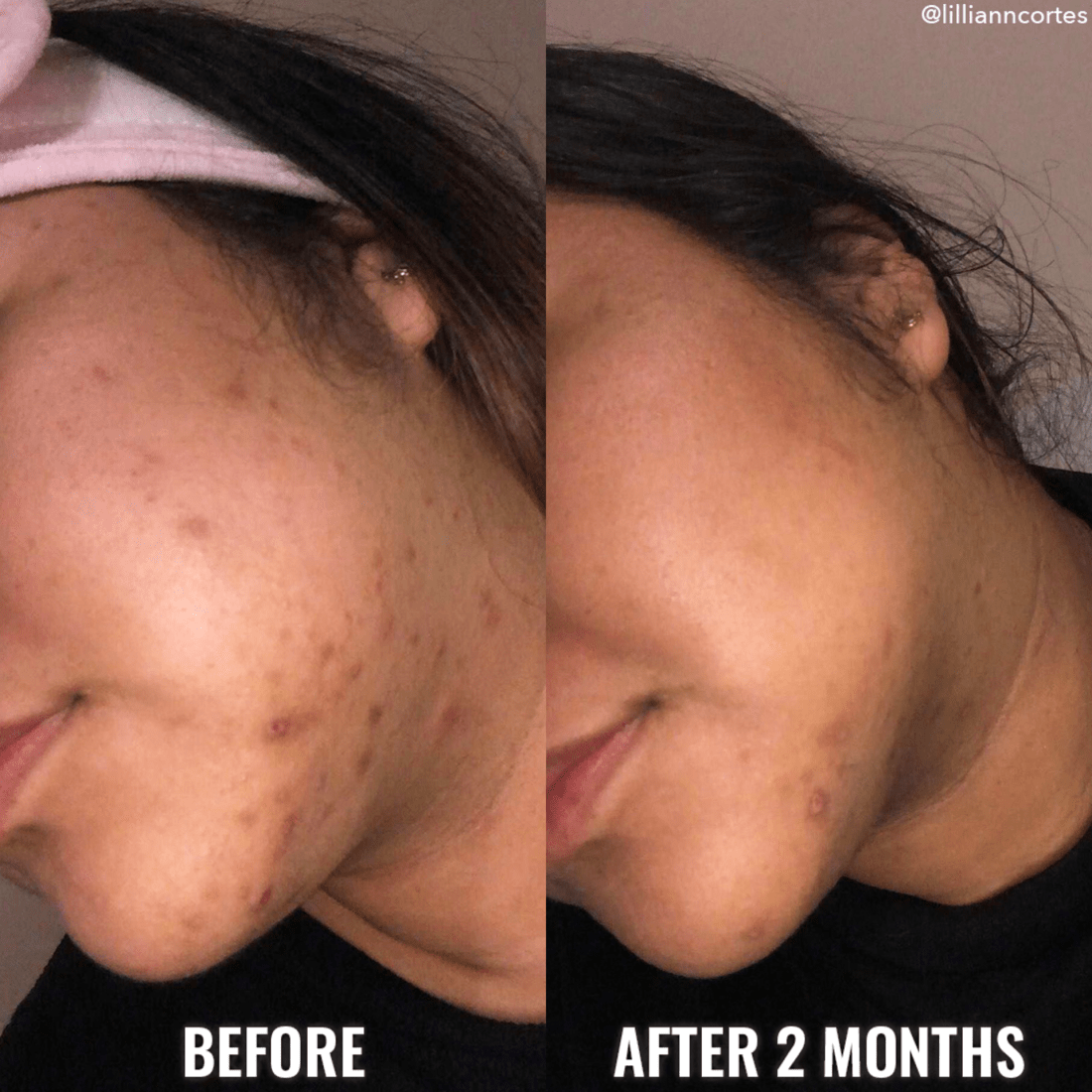 Discoloration Correcting Serum