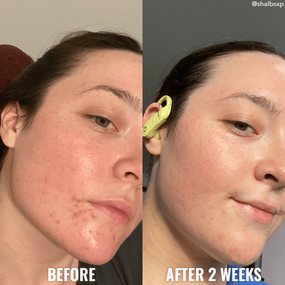 Clarify & Cleanse Bar