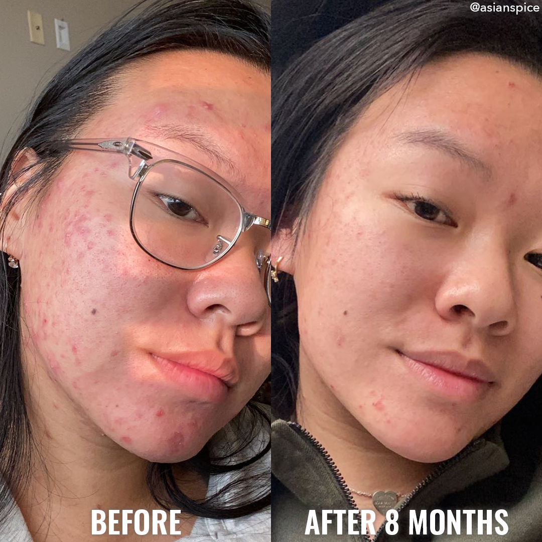 Discoloration Correcting Serum