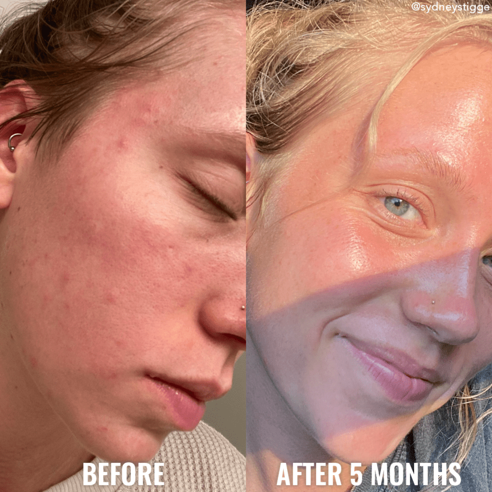 BHA Clarify Gel Cream