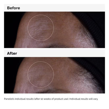 Growth Factors 15% Serum for Visible Skin Repair and Wrinkles (Suero con factores de crecimiento)