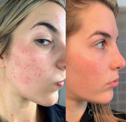 Retinol in Squalane