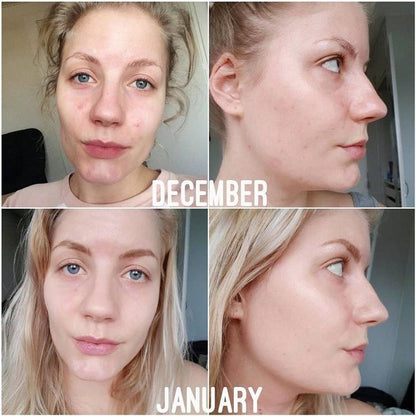 Salicylic Acid 2% Anhydrous Solution