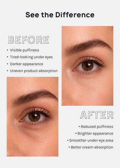 Masajeador para el contorno de ojos "Bright eyes"
