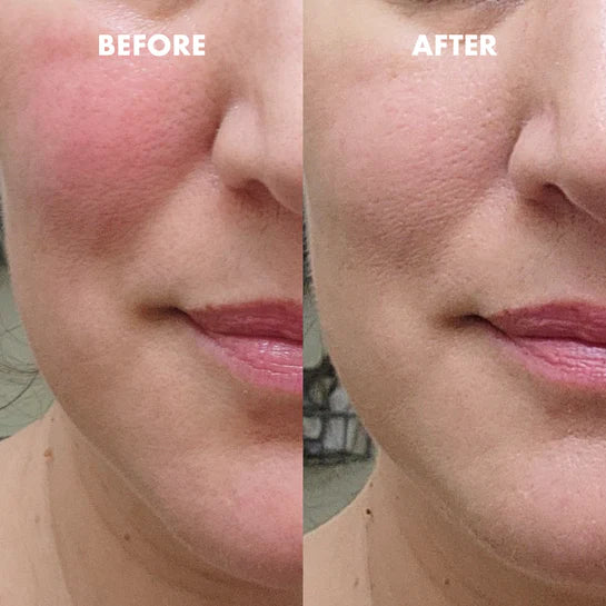 Face Basics Mini set