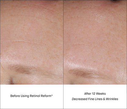 Minis antiaging Retinol duo