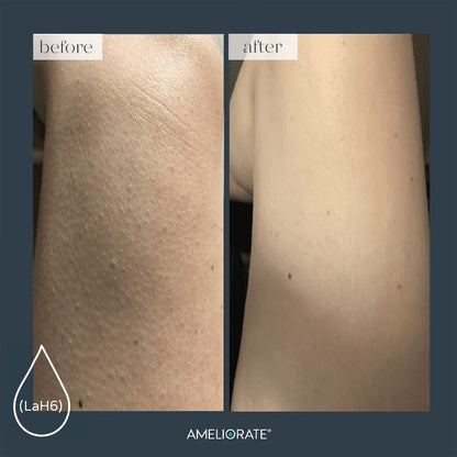 Transforming Body Lotion
