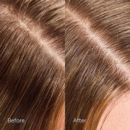 Transforming Scalp Serum -125 ml (Suero Transformador para el Cuero Cabelludo)
