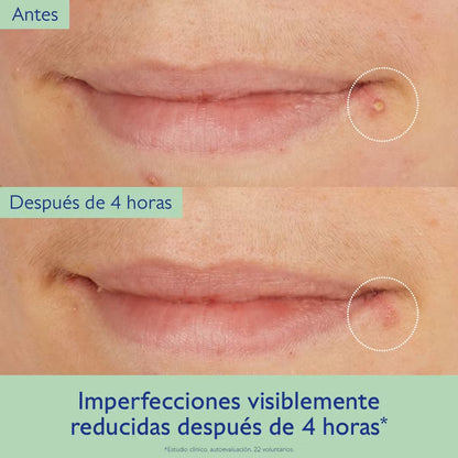 Vinopure Tratamiento de Ácido Salicīlico Natural