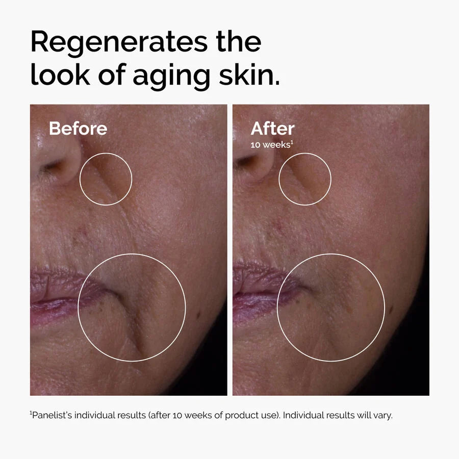 Growth Factors 15% Serum for Visible Skin Repair and Wrinkles (Suero con factores de crecimiento)