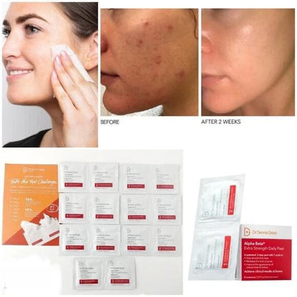 Alpha Beta Extra Strength Daily peel -Take the peel challenge set