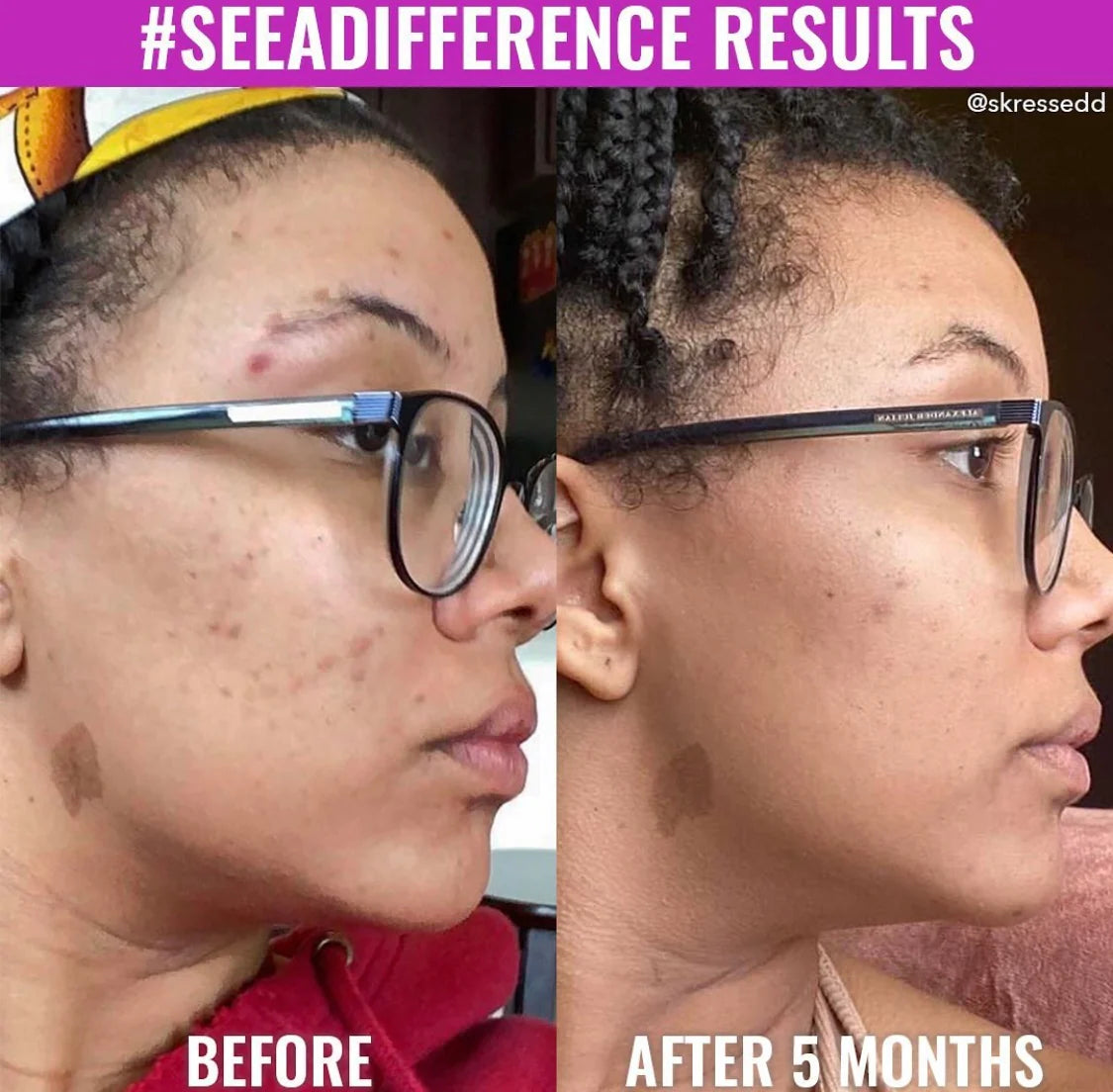 Discoloration Correcting Serum
